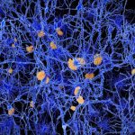 Alzheimer’s disease: surprising new theory about what might cause it