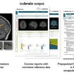 icometrix & Queen Mary University of London receive prestigious AI Award from the National Institute for Health and Care Research (NIHR) to investigate the impact of AI applied to MRI in the care of people with multiple sclerosis (MS)
