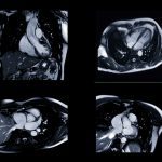 AI can guess racial categories from heart scans – what it means and why it matters